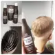 FORTE CAPIL Shampooing, lotion et baume - réduisent la perte de cheveux androgénétique ou hormonale